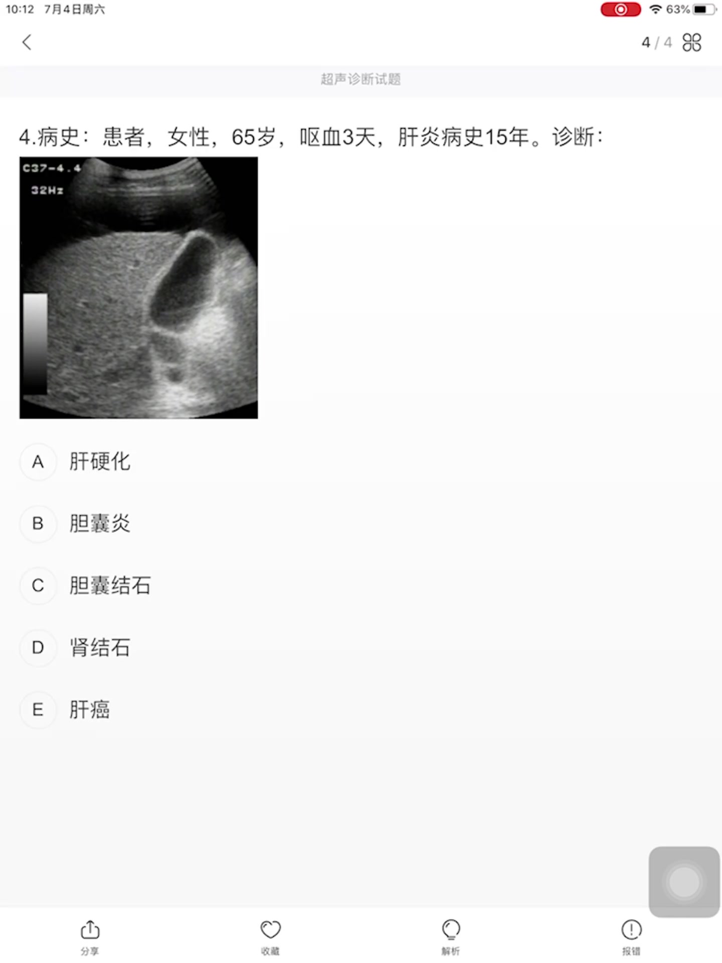 B超怎么看?/医生入门级考试中超声诊断有哪几个病以及考试技巧.哔哩哔哩bilibili