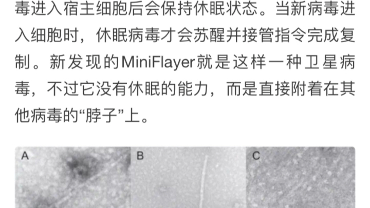 [图]曾经在美国本土发现的吸血鬼病毒 是 人为的 还是 真正自然界 的