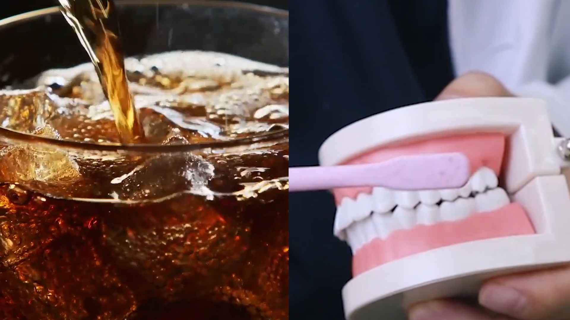 14岁男孩牙全烂惊呆医生,饮料上瘾戴假牙:可乐当水喝还不爱刷牙