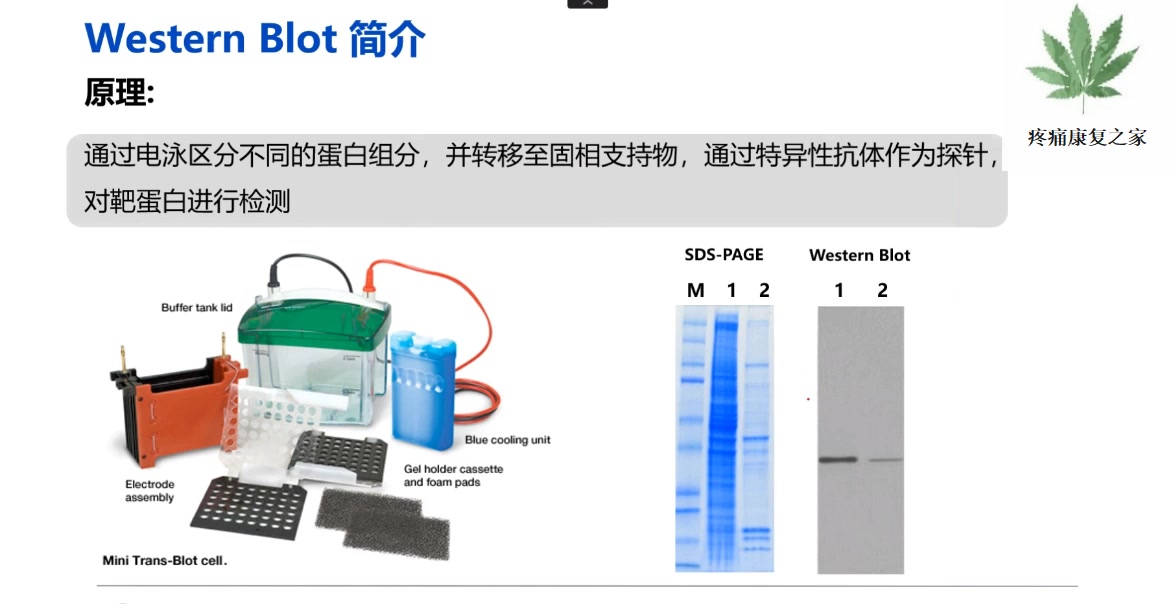 ABcam蛋白印迹讲座哔哩哔哩bilibili