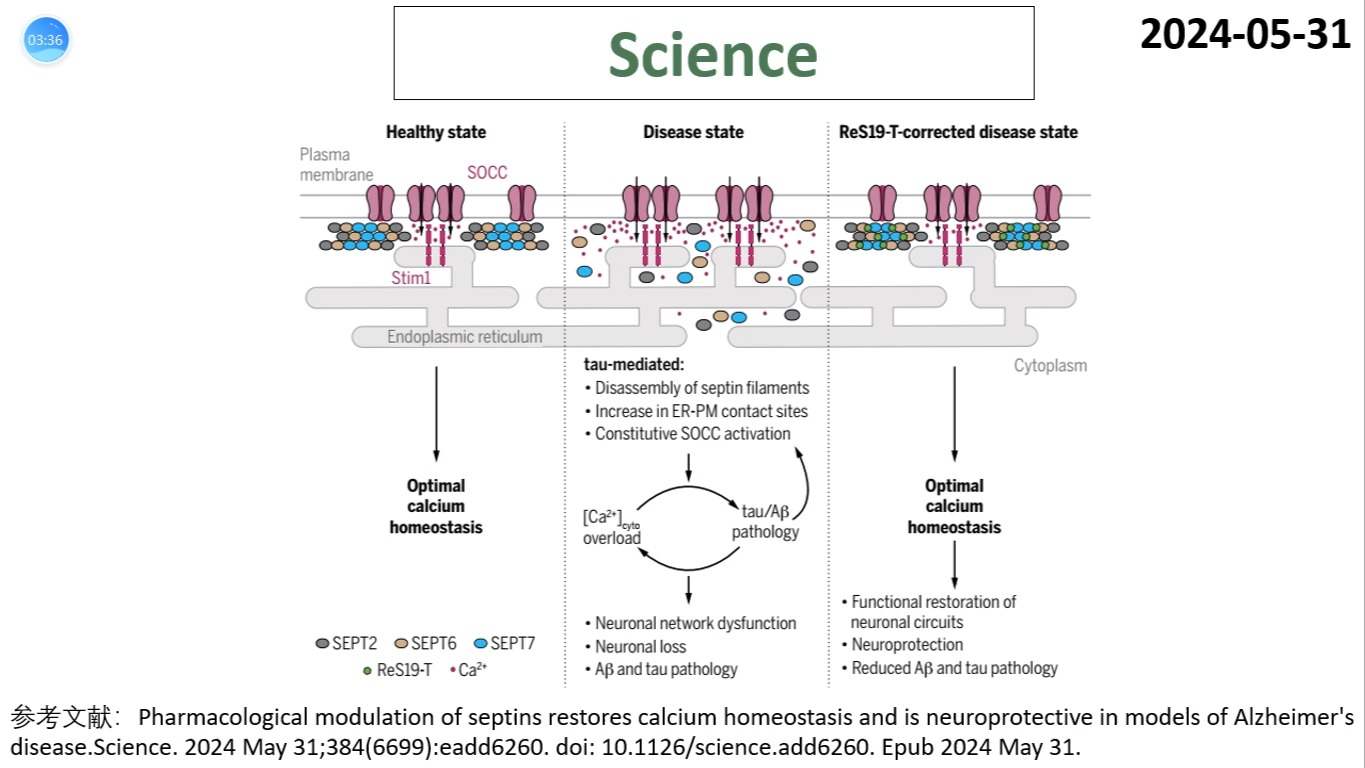 Science—阿尔茨海默病治疗靶点研究绝对重磅:调控septins可纠正AD小鼠模型钙超载并改善认知功能及神经病理哔哩哔哩bilibili