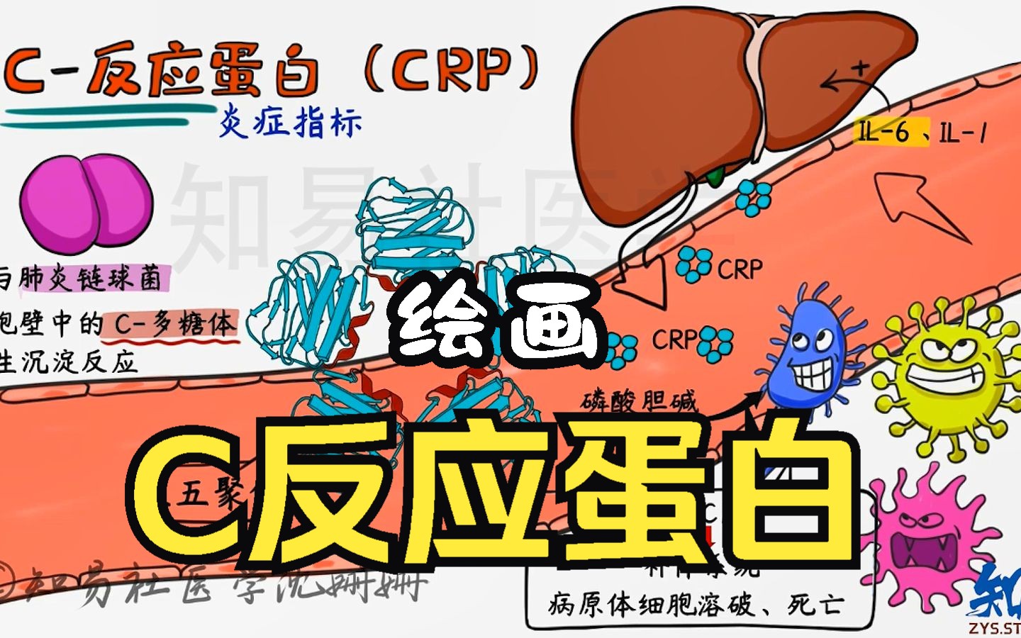 【绘画诊断学】 2分钟记住 C反应蛋白哔哩哔哩bilibili