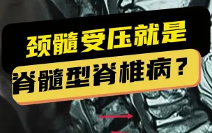 Video herunterladen: 颈椎间盘突出压迫脊髓就是脊髓型颈椎病吗？