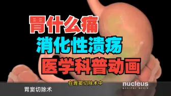 Tải video: 什么是溃疡？消化性溃疡3D动画还原 （nucleus医学科普视频系列）中文