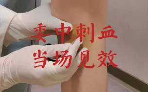 Download Video: 腿部委中刺血，刺痛感当场减轻！