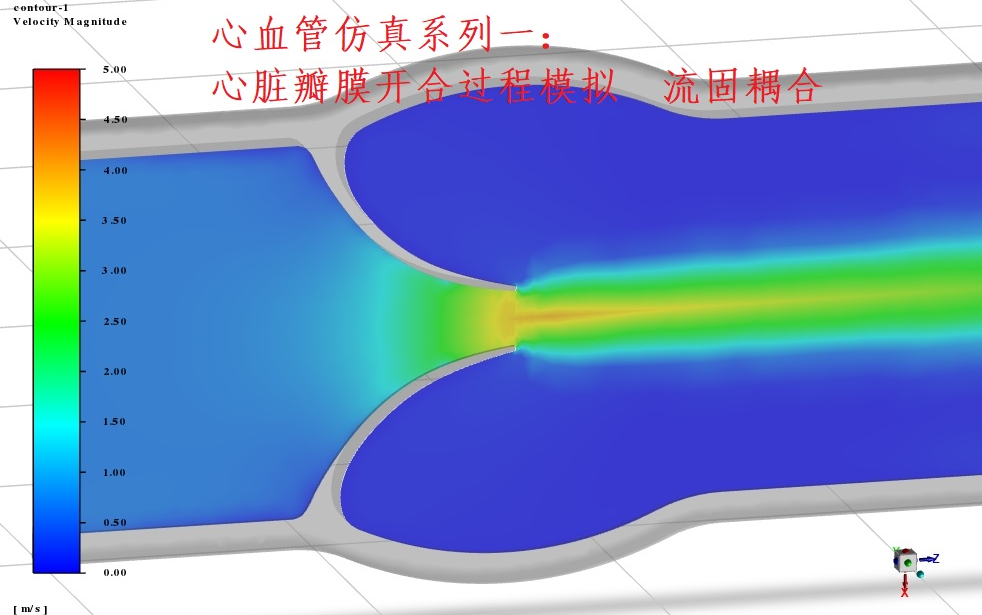 [图]心血管仿真系列一：心脏瓣膜开合过程模拟 流固耦合