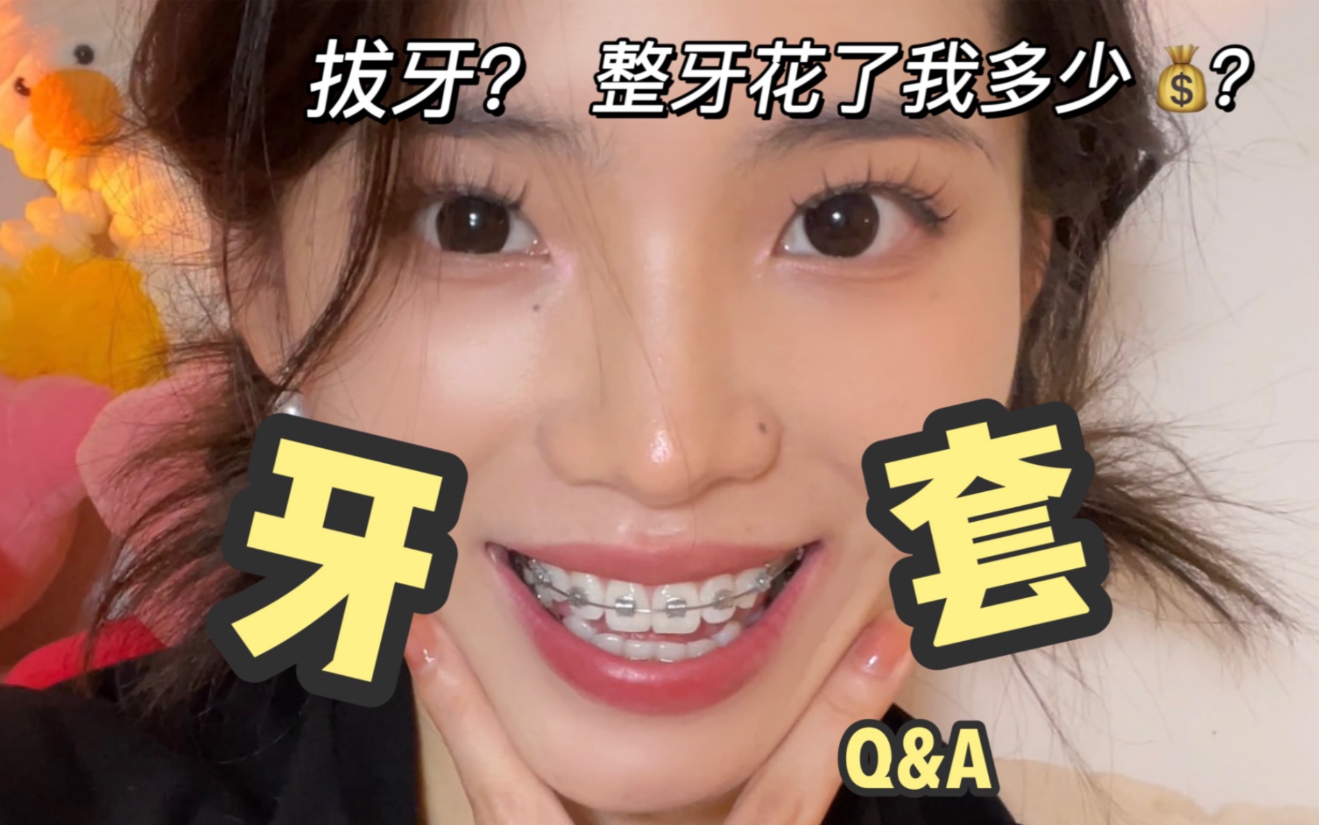 关于我的牙套Q&A:你们想知道的全都有!哔哩哔哩bilibili