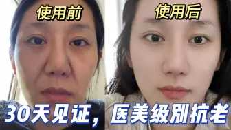 Tải video: 抗老实测一个月，这个国产研发大佬抗老到底有多牛？