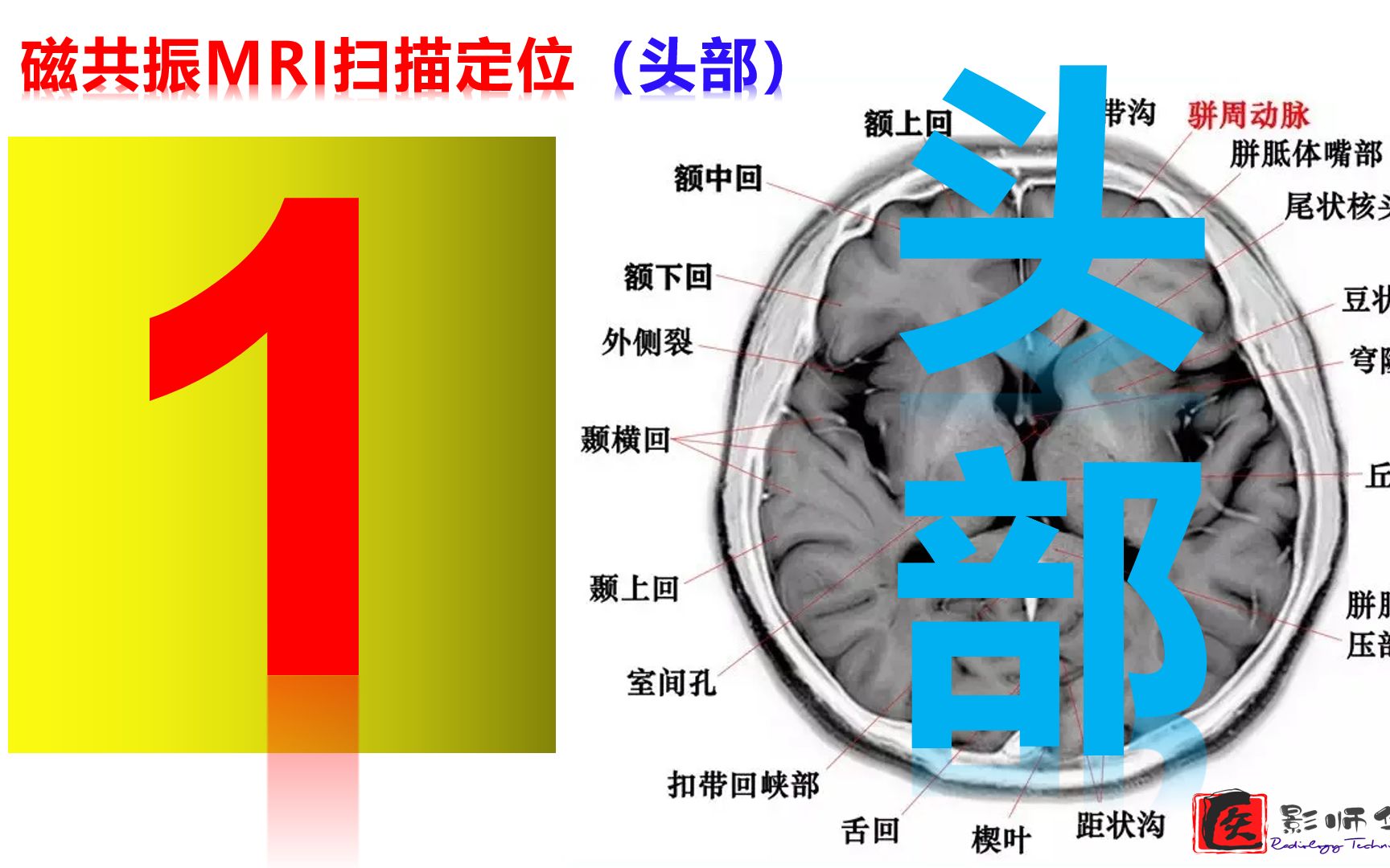 【预告片1】头部磁共振扫描定位线哔哩哔哩bilibili