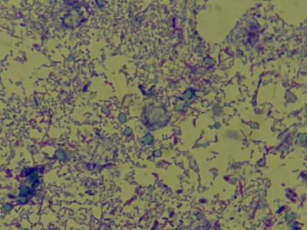 一次失败的空泡型人芽囊原虫染色