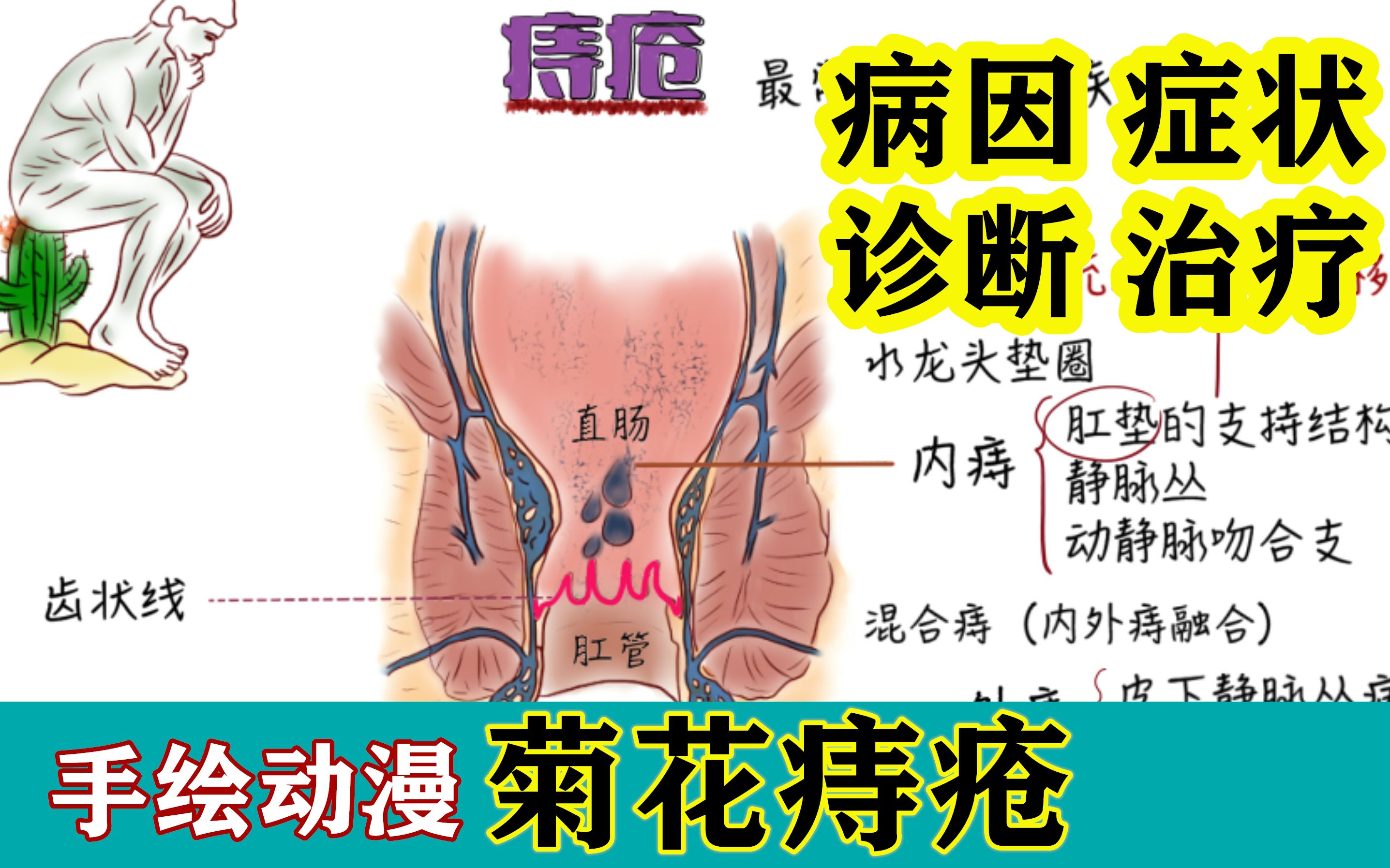 医学动漫|关于菊花【痔疮】的一切!哔哩哔哩bilibili