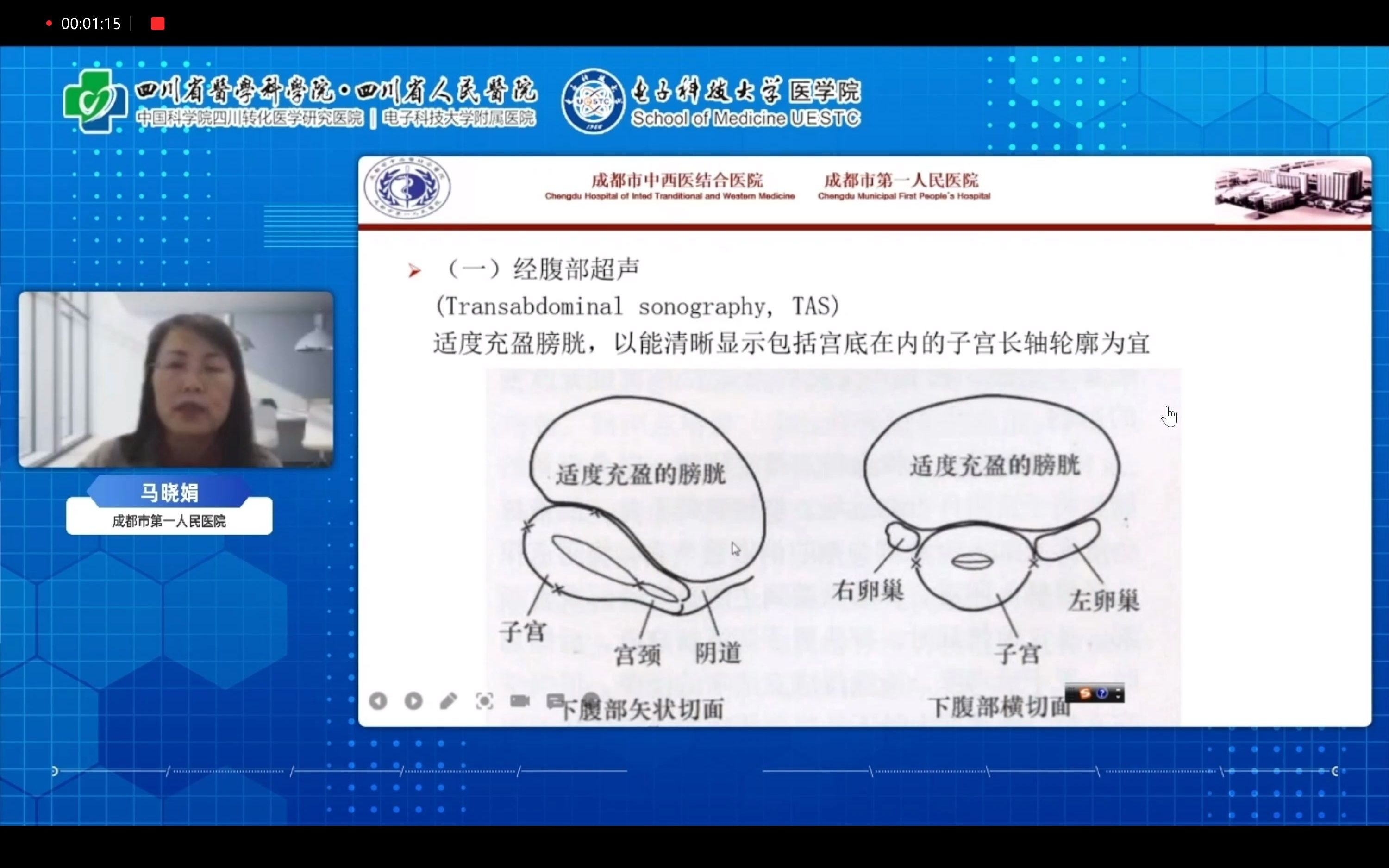 [图]妇科检查规范