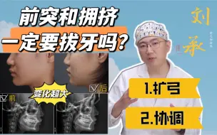 Video herunterladen: 前突和拥挤一定要拔牙吗？