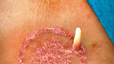 揭秘“癣”真相：别被名字骗了！