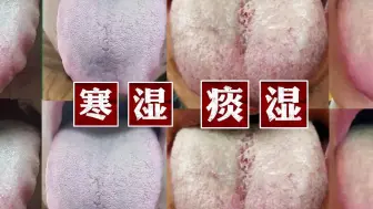 Download Video: 参苓白术散用对了，能横扫体内99%的寒湿、痰湿和湿热！快来看看怎么用吧！