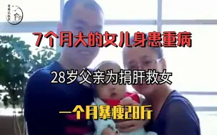 Descargar video: 7个月大的女儿身患重病，28岁父亲为捐肝救女，一个月暴瘦28斤