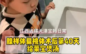 下载视频: 腺样体术后第40天