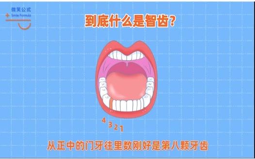 智齿是什么?怎么看自己有没有智齿呢?哔哩哔哩bilibili