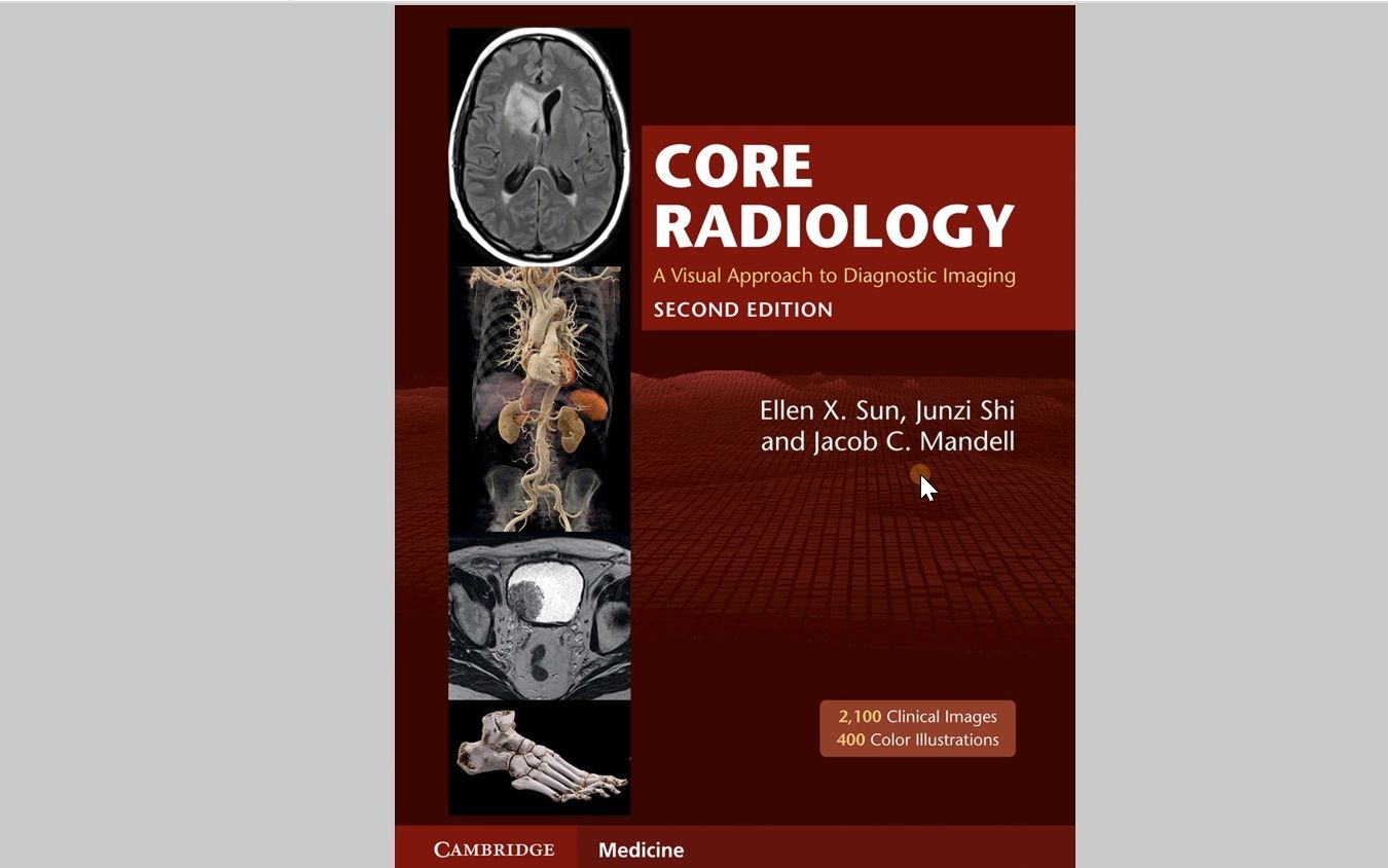 核心放射学第二版介绍(Core Radiology: A Visual Approach to Diagnostic Imaging)哔哩哔哩bilibili