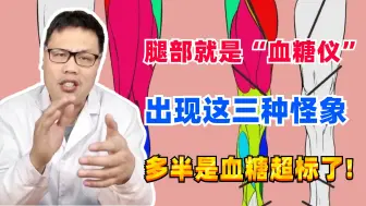 Download Video: 腿部就是“血糖仪”，出现这三种怪象，多半是血糖超标了!