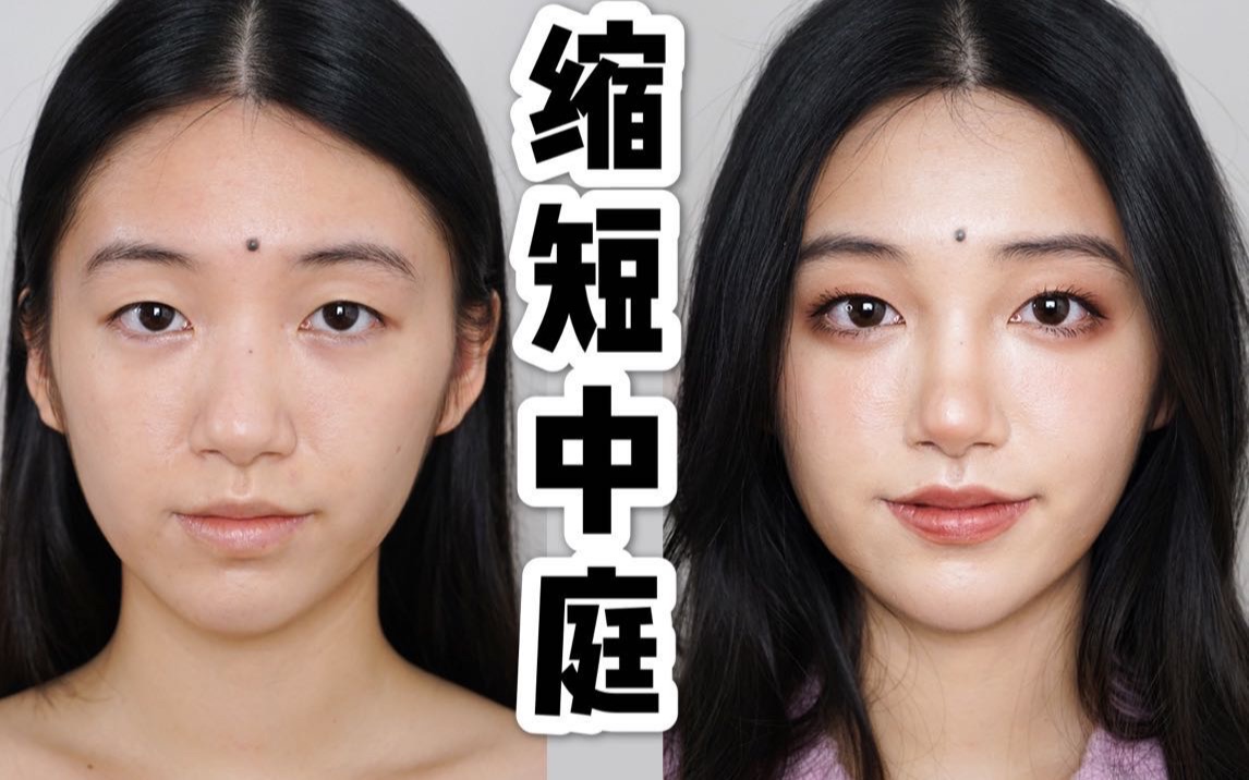 硬核缩短长中庭! 不整容优化面部比例 总有一款适合你