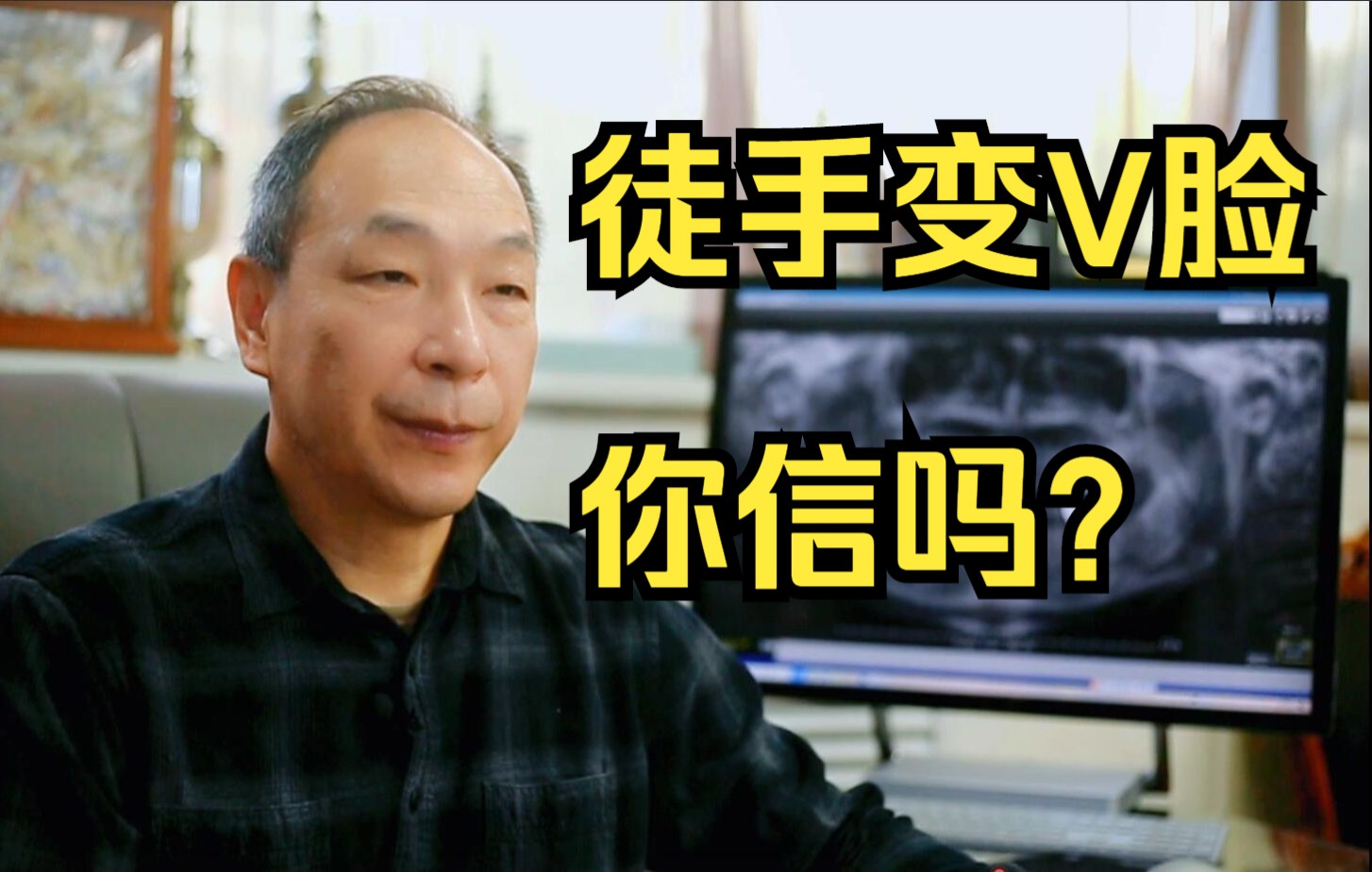 【颌面医生张立天】徒手变V脸,你信吗?哔哩哔哩bilibili