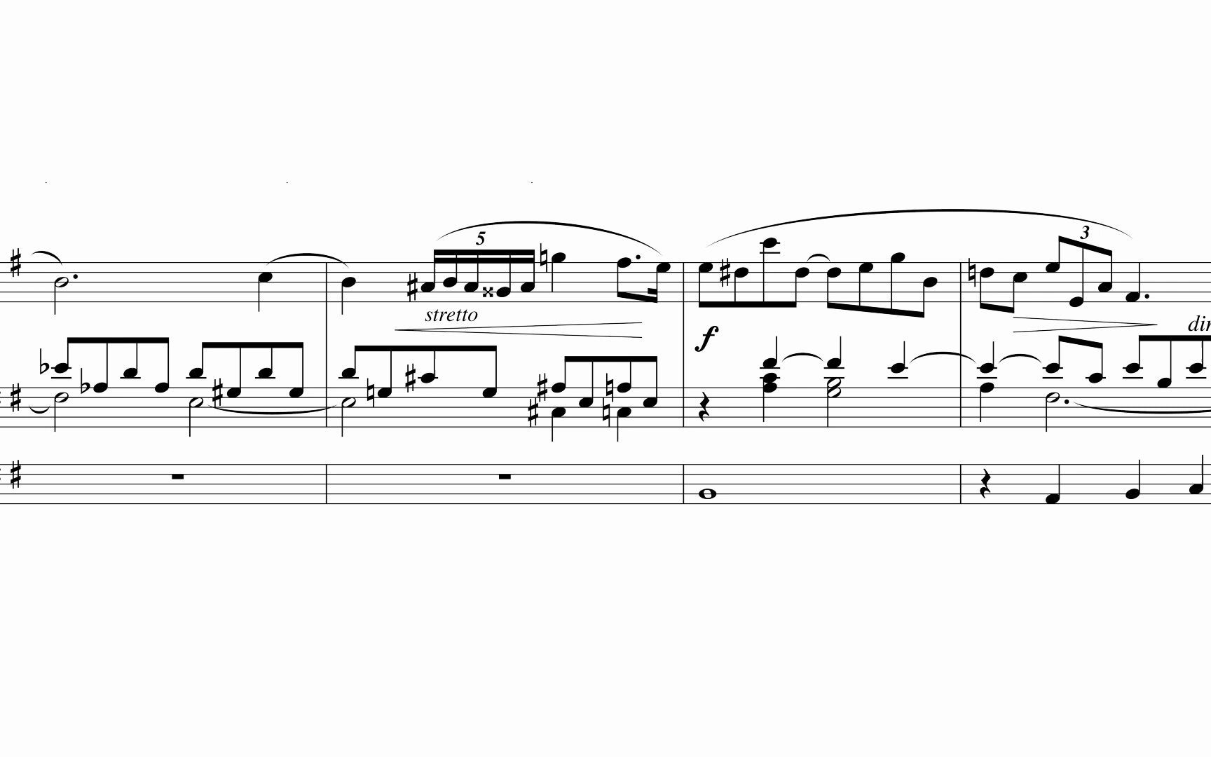 管风琴李斯特改编肖邦前奏曲op28no4