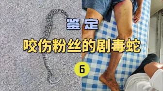 Tải video: 鉴定咬伤粉丝的毒蛇(6)粉丝家人疑似被五步蛇咬伤！却发来一张无毒蛇照片？到底怎么回事？