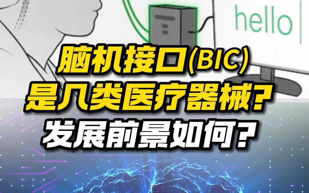 脑机接口(BIC)是几类医疗器械?发展前景如何?哔哩哔哩bilibili