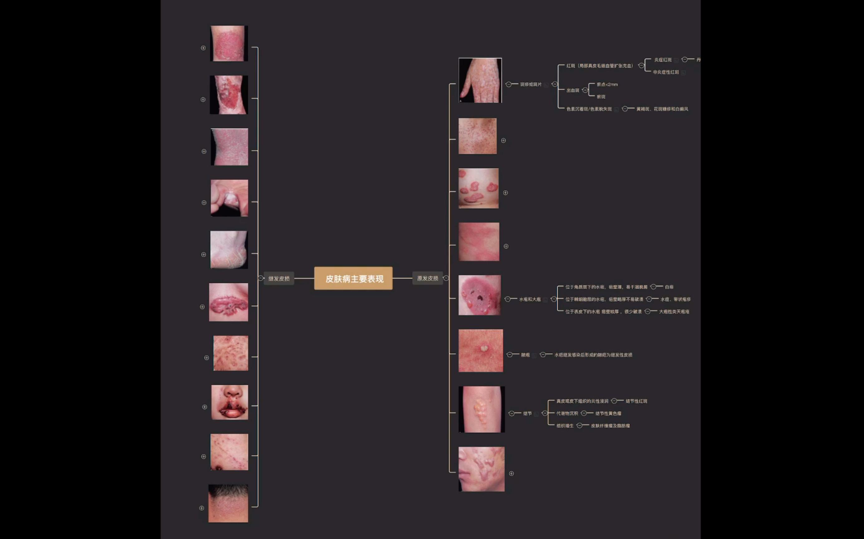 [图]【皮肤性病学】记不住各种皮损形态？ 人卫九版整理 思维导图分享