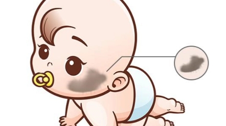 宝宝的伊藤痣会不会自己没有