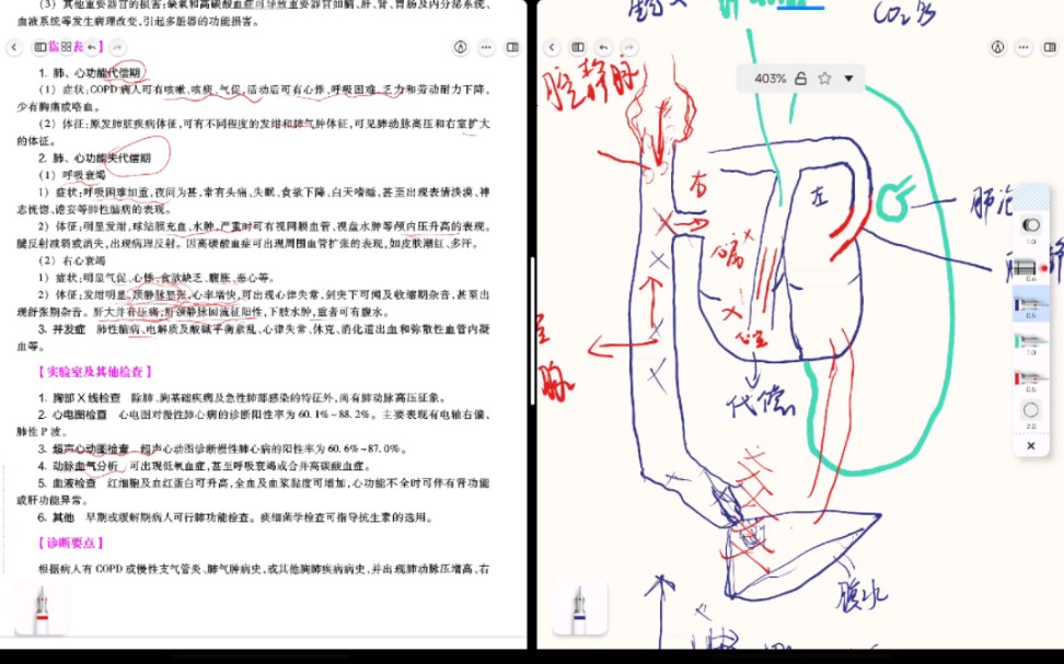 [图]内科护理学-肺心病（护理考研）第七版教材