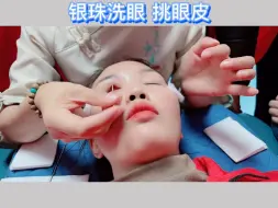 Скачать видео: 银珠洗眼经典手法之一：挑眼皮，过程心惊肉跳，体验者酸爽至极，你敢试试吗？