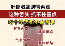 Download Video: 肝肾两虚，肝郁湿盛，抓不住这两点，吃药也白搭