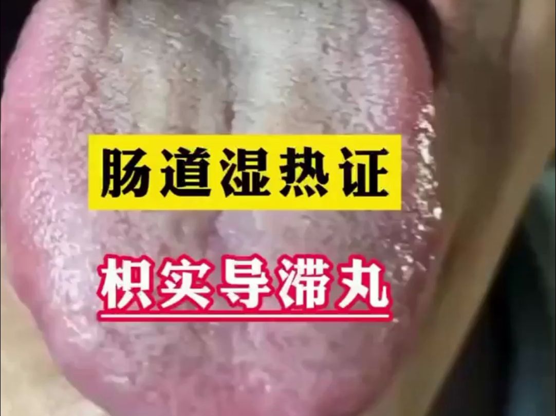 舌边红,舌尖红,舌苔黄黄腻,湿热证型,送你1方
