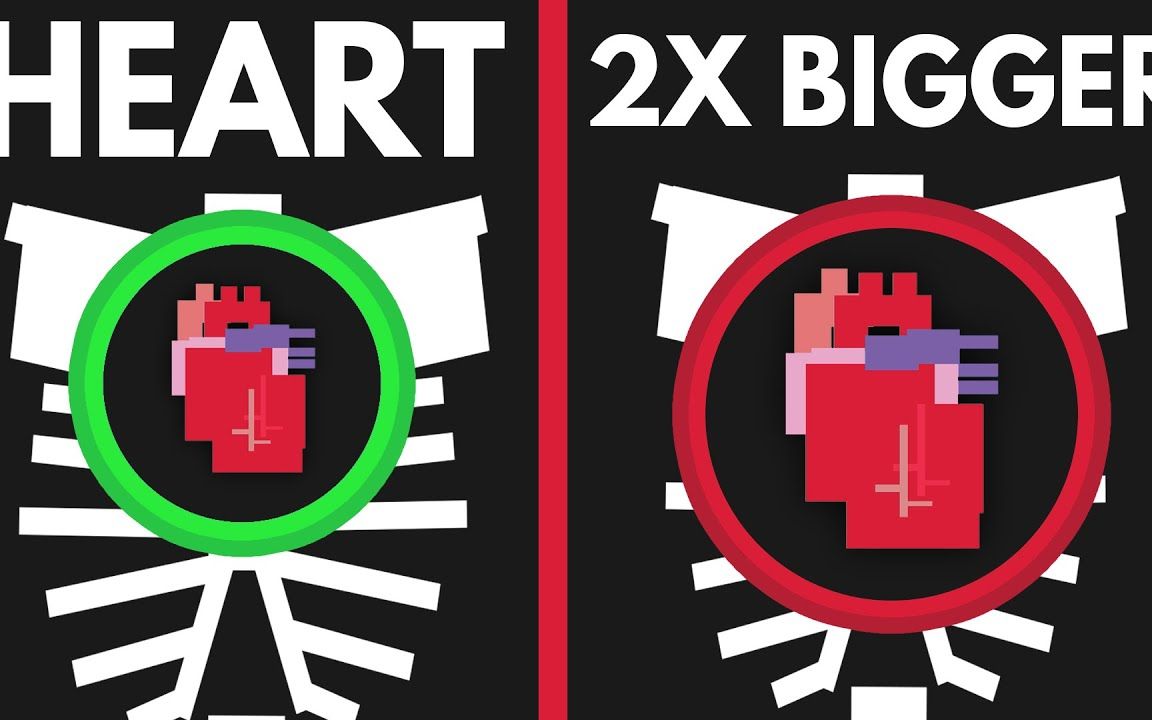 如果你的心脏变大两倍会怎么样?【lifenoggin】
