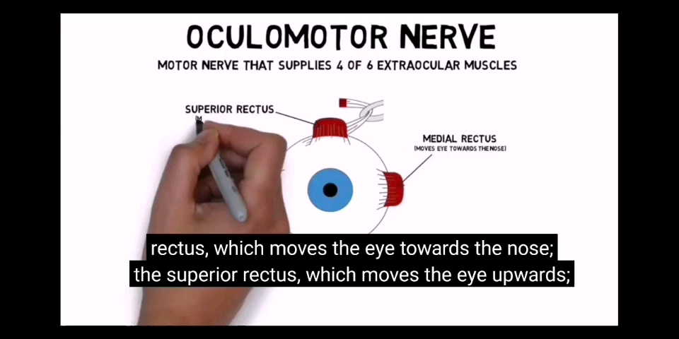 [图]Oculomotor nerve