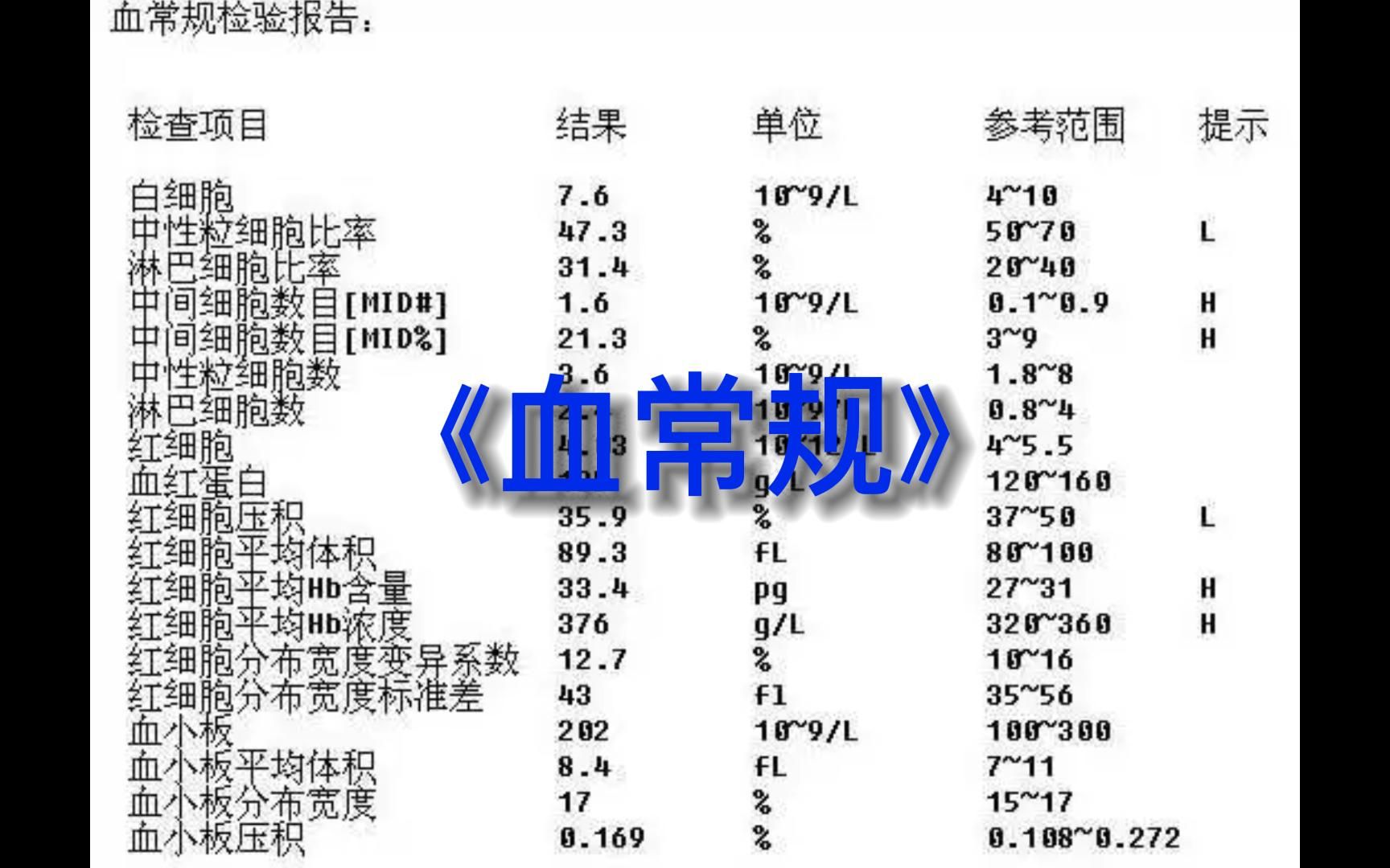 快速读懂血常规哔哩哔哩bilibili