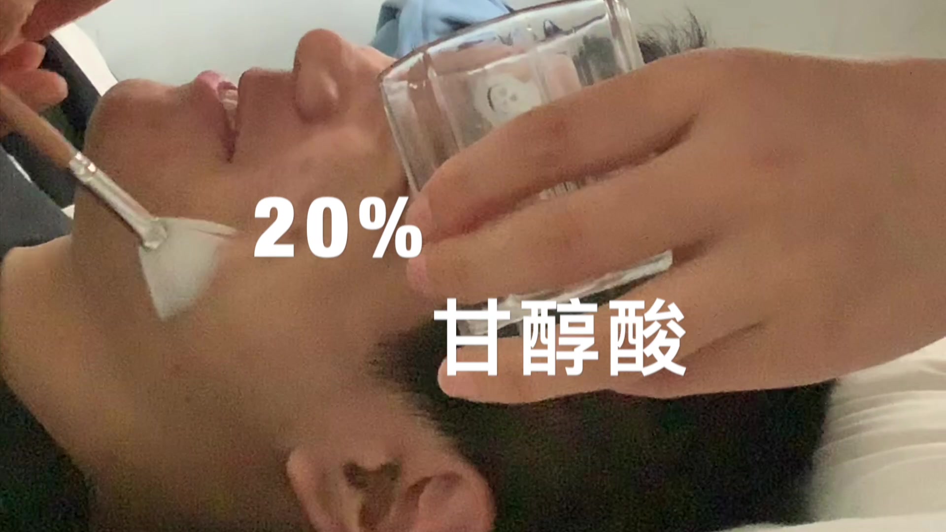 刷酸 20%甘醇酸 去闭口哔哩哔哩bilibili