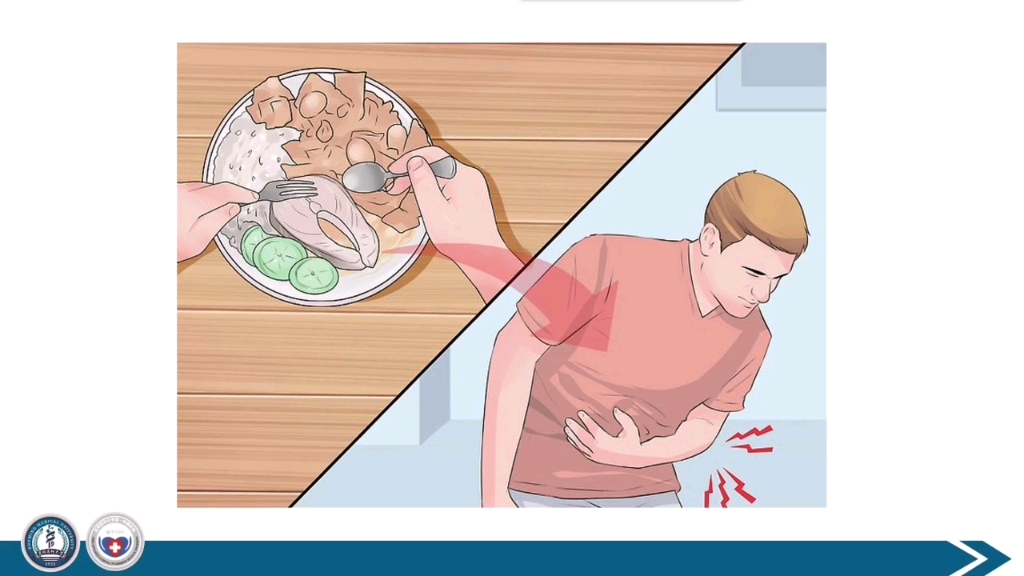 简单易学的医学影像学——急性胰腺炎_哔哩哔哩_bilibili