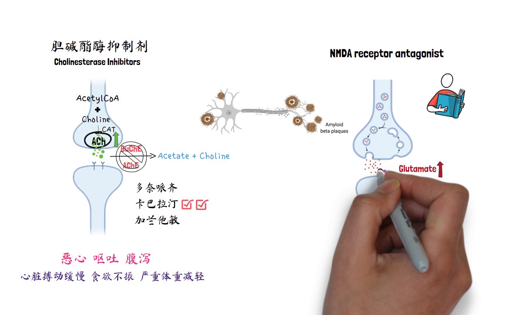 【药理学】治疗阿尔兹海默症(老年痴呆症)的药物 Alzheimer's disease哔哩哔哩bilibili