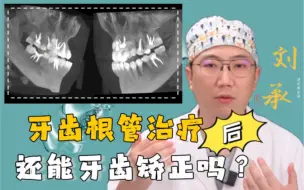 Download Video: 牙齿做了根管治疗后还能不能牙齿矫正？