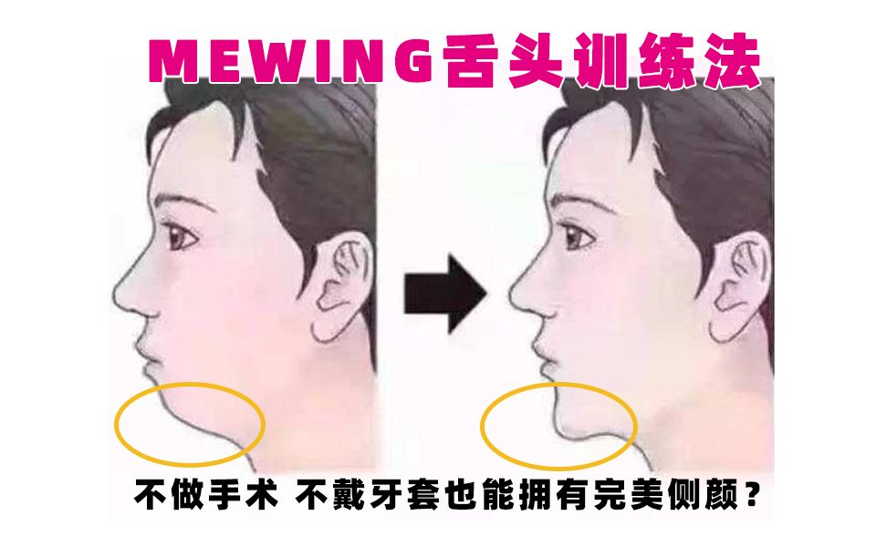 不开刀不戴牙套就能改善后缩下巴mewing舌头训练可否塑造完美侧颜脸型