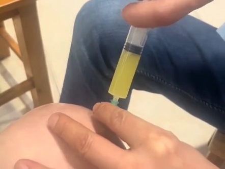 膝盖抽积液一点不疼 #老铁笑一笑 #搞笑视频 #快乐计划