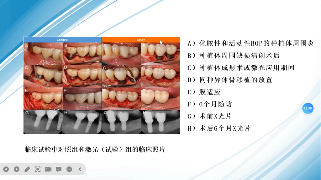 组会文献汇报,试讲,巨困.丑媳妇还是要见公婆的[保卫萝卜哭哭]窒息.请问有没有一言能被老师cue到的时候说出来,既不冷场,又显示出自己态度端...