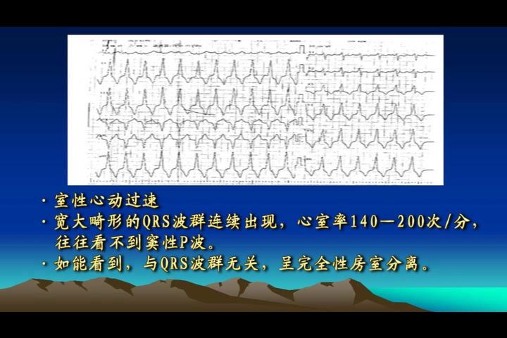 颐恒心电图速成讲授哔哩哔哩bilibili