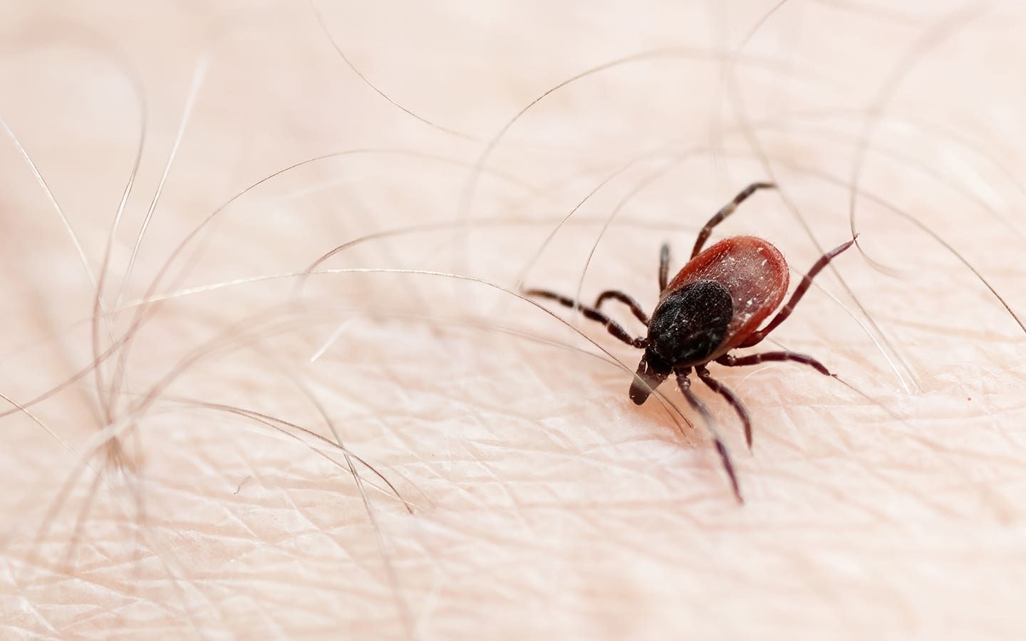 蜱虫被称为"夺命虫"危害有多大?大连女子被咬,一周后不幸身亡