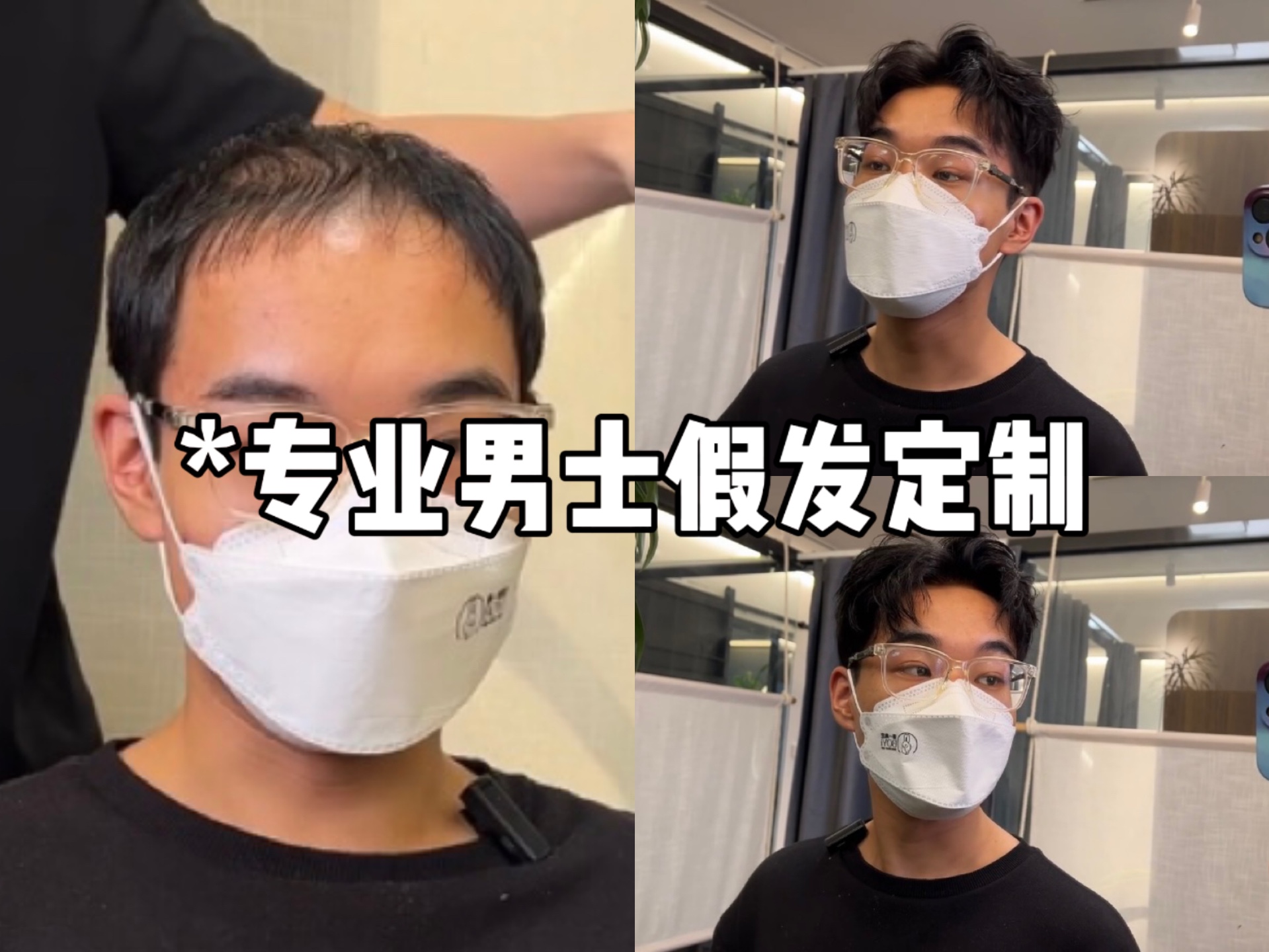 小哥因头发问题一直找不到女朋友,来找我们改变#男士假发 #玺涵假发 #男士补发 #假发补发#增加发量#假发#假发片#头顶假发#北京男生假发#上海男生假...