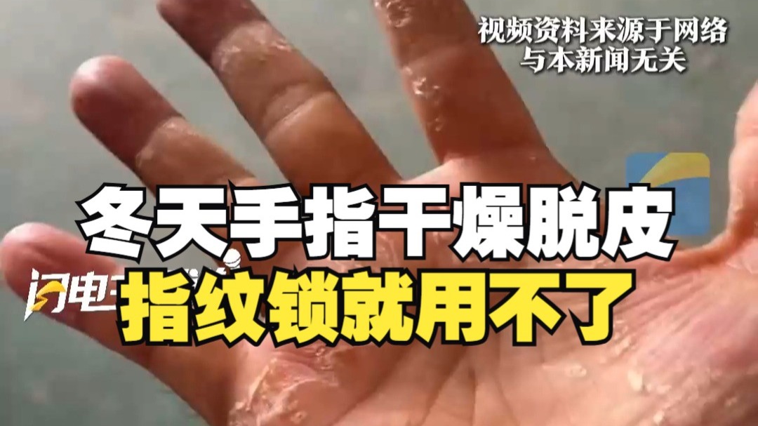 冬天手指干燥脱皮指纹锁就用不了!男子在线求救