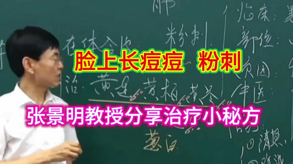 张景明教授分享治疗痘痘小秘方,简单,根治哔哩哔哩bilibili